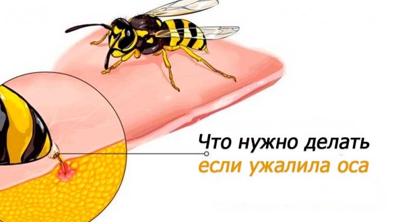 Что делать, если укусила оса